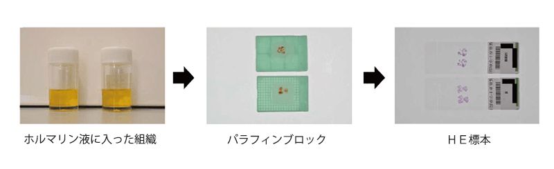 生検診断