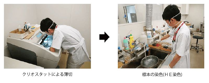 手術中の迅速診断