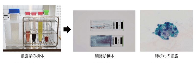 細胞診断