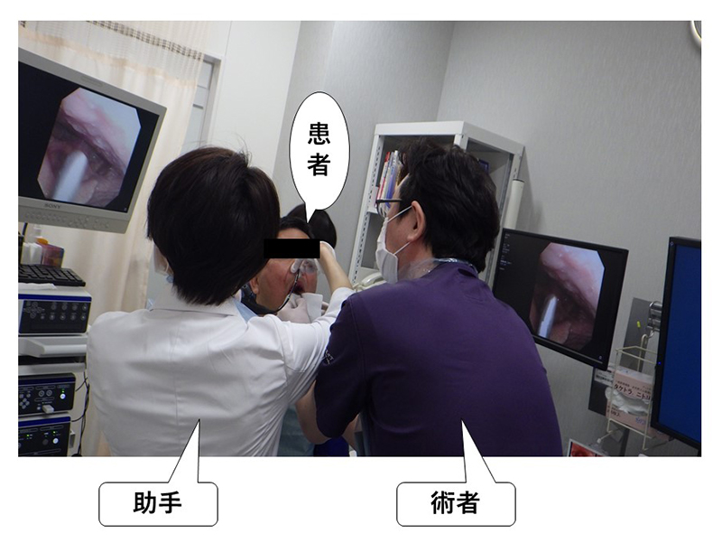 局所麻酔でおこなう喉頭内視鏡手術